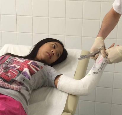 Kids Accident - Broken Arm, getting cast removed from healed broken bones